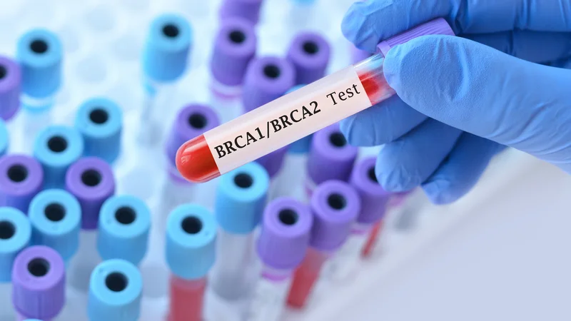 تصویر پزشکی از رشته DNA و ژن‌های BRCA1 و BRCA2 در آزمایش ژنتیکی